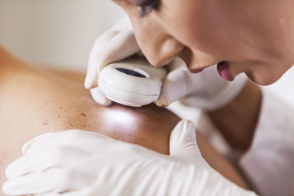 Dermatology